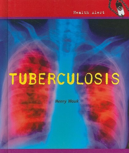 Tuberculosis