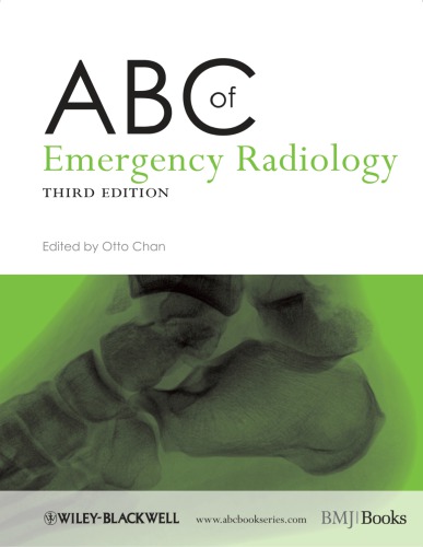 ABC of emergency radiology