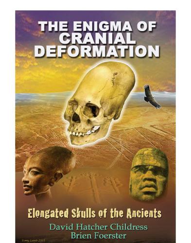 The Enigma of Cranial Deformation