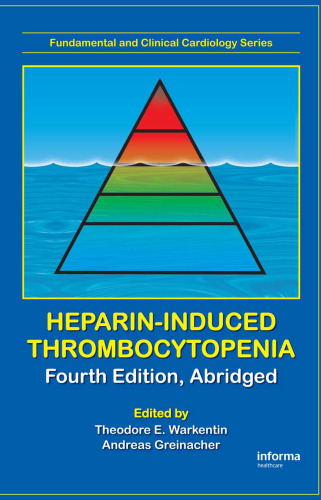 Heparin-Induced Thrombocytopenia