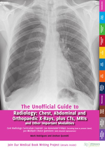 The Unofficial Guide to Radiology: Chest, Abdominal, Orthopaedic X Rays, plus CTs, MRIs and Other Important Modalities