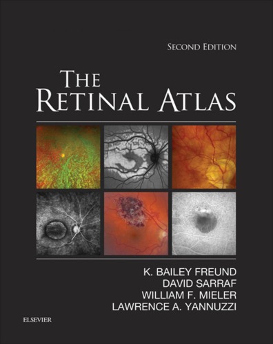 Retinal atlas