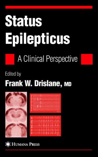 Status Epilepticus: A Clinical Perspective