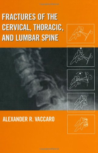 Fractures of the Cervical, Thoracic, and Lumbar Spine