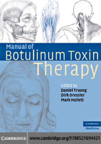 Manual of Botulinum Toxin Therapy