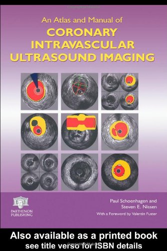 An Atlas and Manual of Coronary Intravascular Ultrasound Imaging