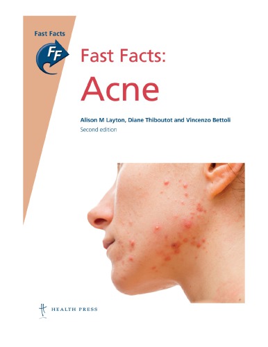 Fast Facts: Acne