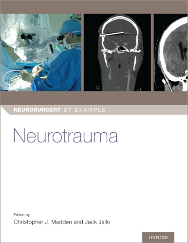 Neurotrauma (Neurosurgery by Example)