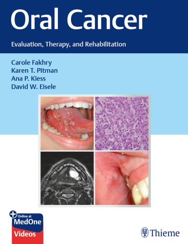 Oral Cancer: Evaluation, Therapy, and Rehabilitation