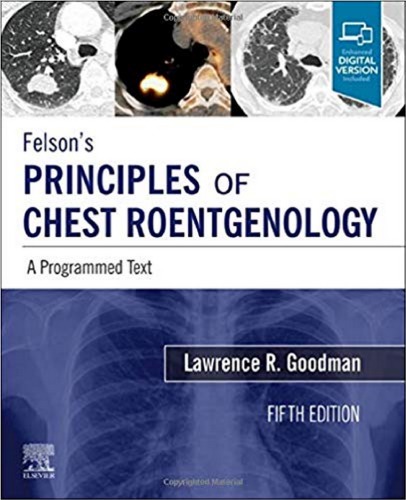 Felson’s Principles of Chest Roentgenology: A Programmed Text