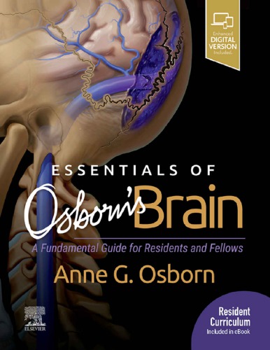 Essentials of Osborn’s Brain: A Fundamental Guide for Residents and Fellows