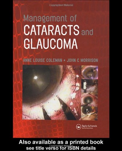 Management of Cataracts and Glaucoma