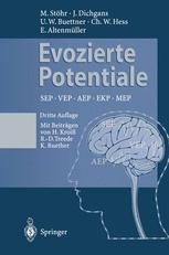 Evozierte Potentiale: SEP · VEP · AEP · EKP · MEP