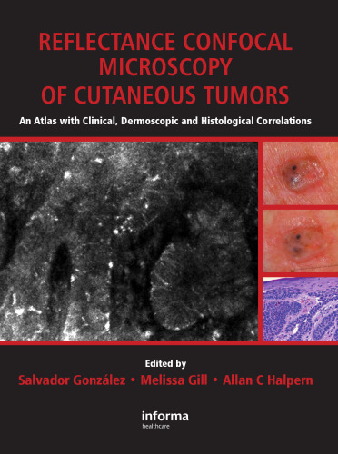 Reflectance Confocal Microscopy of Cutaneous Tumors: An Atlas with Clinical, Dermoscopic and Histological Correlations