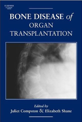 Bone Disease of Organ Transplantation