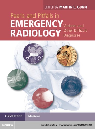 Pearls and pitfalls in emergency radiology: variants and other difficult diagnoses