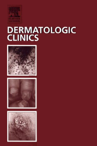 Internal Malignancy and The Skin: Paraneoplastic and Cancer Treatment-Related Cutaneous Disorders, An Issue of Dermatologic Clinics