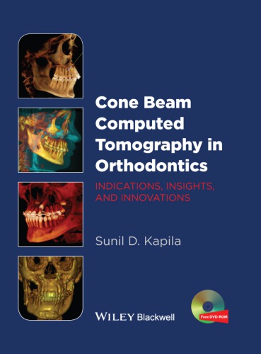 Cone beam computed tomography in orthodontics: indications, insights, and innovations