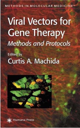 Viral Vectors for Gene Therapy: Methods and Protocols