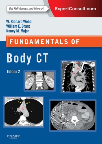 Fundamentals of body CT