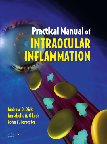 Practical Manual of Intraocular Inflammation