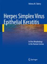 Herpes Simplex Virus Epithelial Keratitis: In Vivo Morphology in the Human Cornea