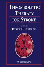 Thrombolytic Therapy for Stroke