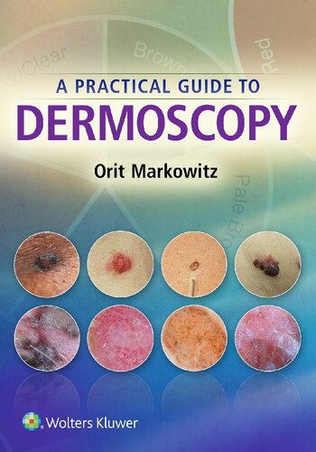 A Practical Guide to Dermoscopy