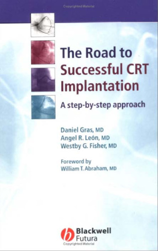 The Road to Successful CRT System Implantation: A Step-by-Step Approach