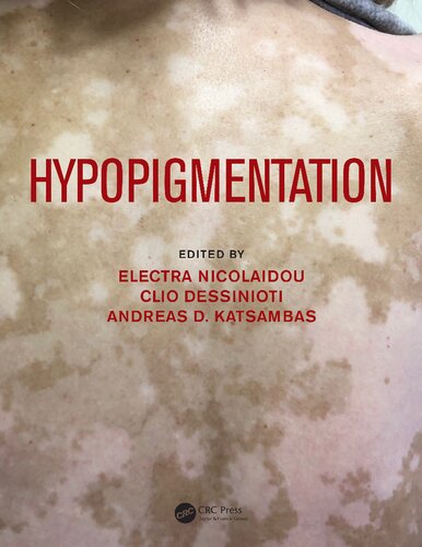 Hypopigmentation