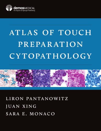 Atlas of touch preparation cytopathology