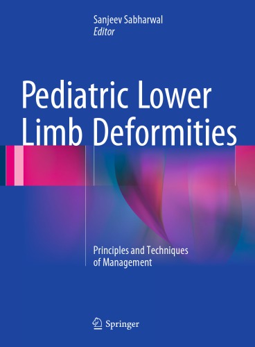 Pediatric lower limb deformities: principles and techniques of management