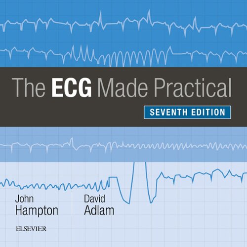 The ECG Made Practical