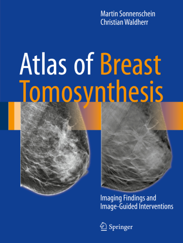 Atlas of Breast Tomosynthesis Imaging Findings and Image-Guided Interventions