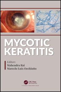 Mycotic Keratitis