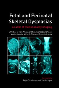 Fetal and Perinatal Skeletal Dysplasias: an Atlas of Multimodality Imaging