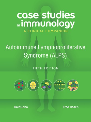 Case studies in immunology: a clinical companion: autoimmune lymphoproliferative syndrome (ALPS)