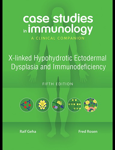 Case Studies in Immunology: X-linked Hypohydrotic Ectodermal Dysplasia and Immunodeficiency: a Clinical Companion