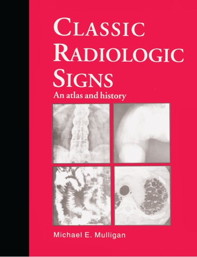 Classic radiologic signs an atlas and history