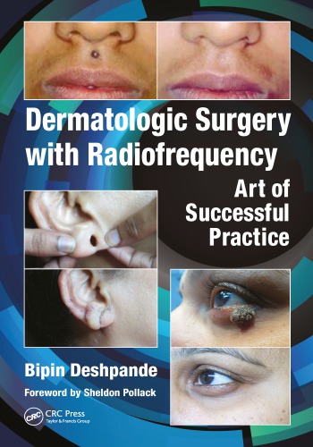 Dermatologic surgery with radiofrequency: art of successful practice