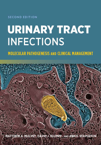 Urinary tract infections: molecular pathogenesis and clinical management