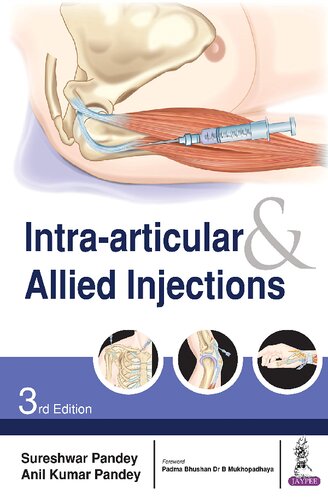 Intra-articular and Allied Injections