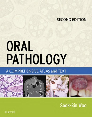 Oral Pathology: A Comprehensive Atlas and Text