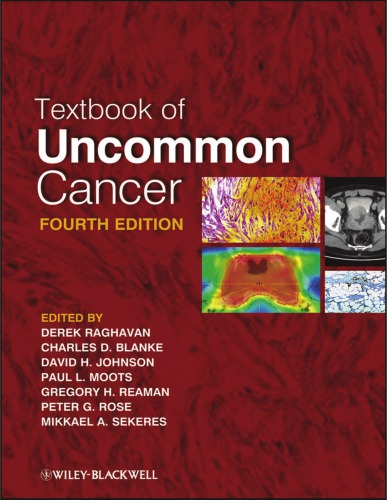 Textbook of Uncommon Cancer