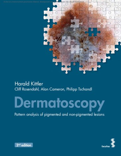 Dermatoscopy - Pattern analysis of pigmented and non-pigmented lesions