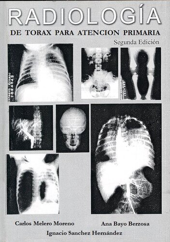 Radiologia de Torax para atencion primaria