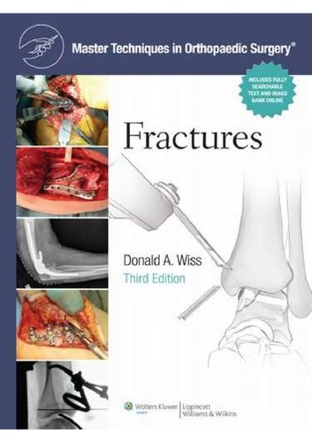 Master Techniques in Orthopaedic Surgery Fractures Third Edition