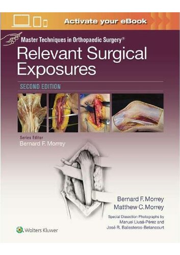 Master Techniques in Orthopaedic Surgery Relevant Surgical Exposures 2nd Edition