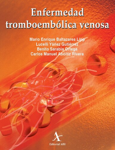 Enfermedad tromboembÃ³lica venosa