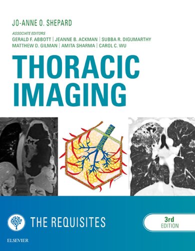 Thoracic Imaging: The Requisites (Requisites in Radiology)